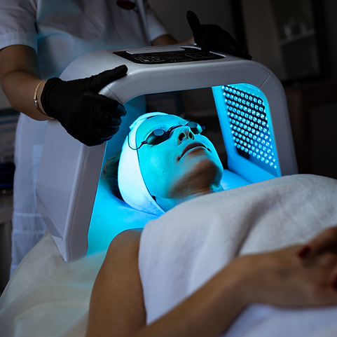 SOOPA HOCL RESCUE MIST INTENSE 100ML